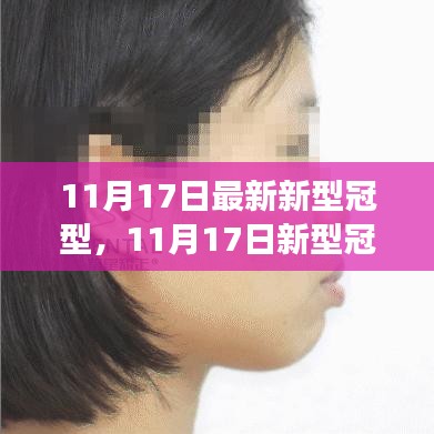 11月17日新型冠型最新进展与观点探讨